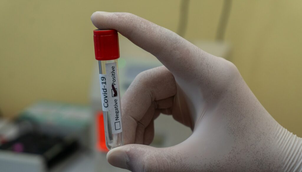 Βρετανία: Προειδοποίηση για 75.000 νεκρούς από Covid μέχρι την άνοιξη