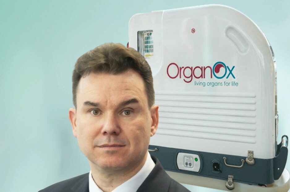 OrganOx: Η spinout με το ελληνικό DNA, που πωλείται για 1,5 δισ. στην ιαπωνική Terumo