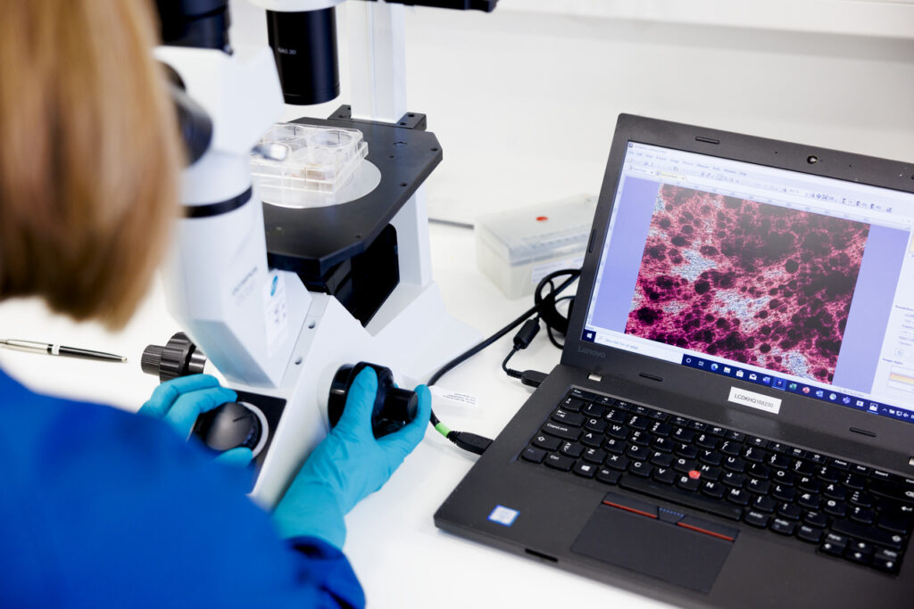 Kλινικές δοκιμές: Πολλαπλασιαστής καινοτομίας, οικονομίας και κοινωνικής αξίας – Το παράδειγμα της Novo Nordisk Hellas